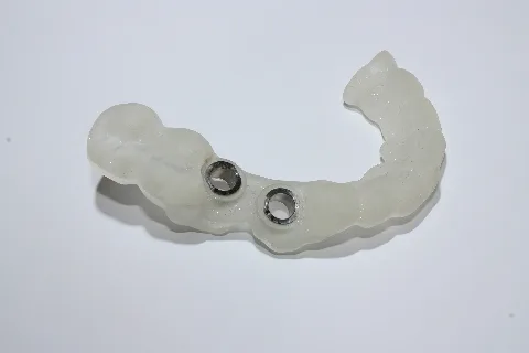 Bohrschablone Für 2 Implantate,