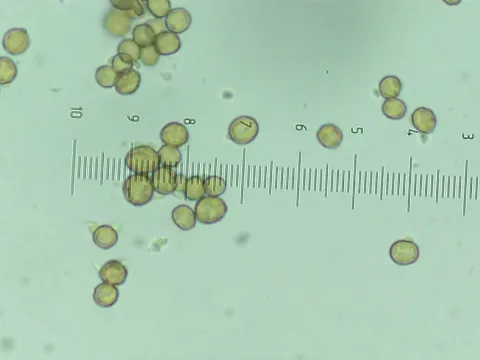 Chaenotheca Trichialis 57239057