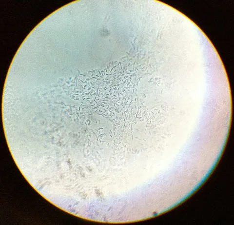 Clostridium Acetobutylicum