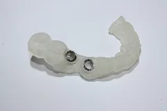 Bohrschablone Für 2 Implantate,