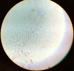 Clostridium Acetobutylicum